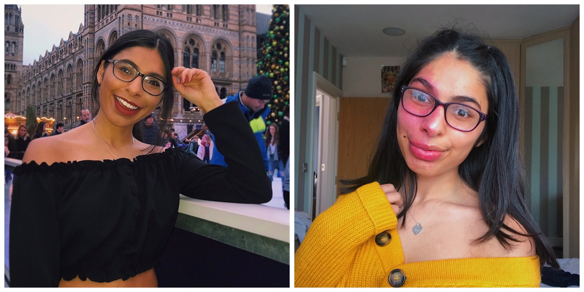 Two images: on the left, a woman in a black top and glasses smiles. She is sitting next to an ice rink. On the left, she wears a yellow cardigan.