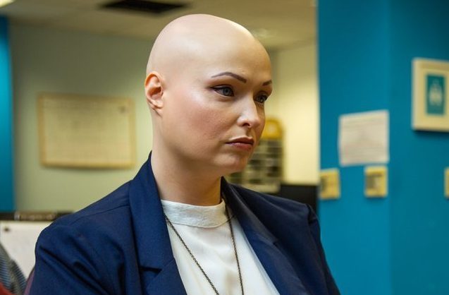 A woman with alopecia wearing a blue blazer and white top sits at a computer, typing.