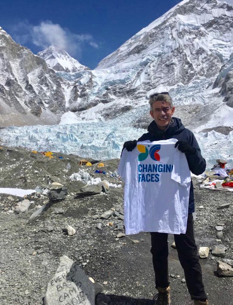 A man with a port wine birthmark holds a Changing Faces t-shirt. He is standing at Everest base camp, snowy mountains behind him.