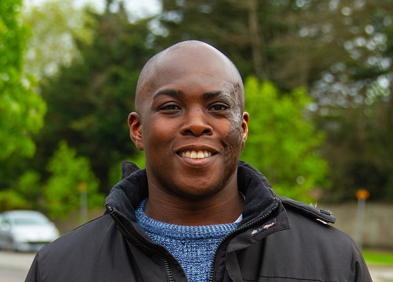 A man with scars from burns on his face smiles at the camera. He is wearing a black jacket with a blue jumper underneath.