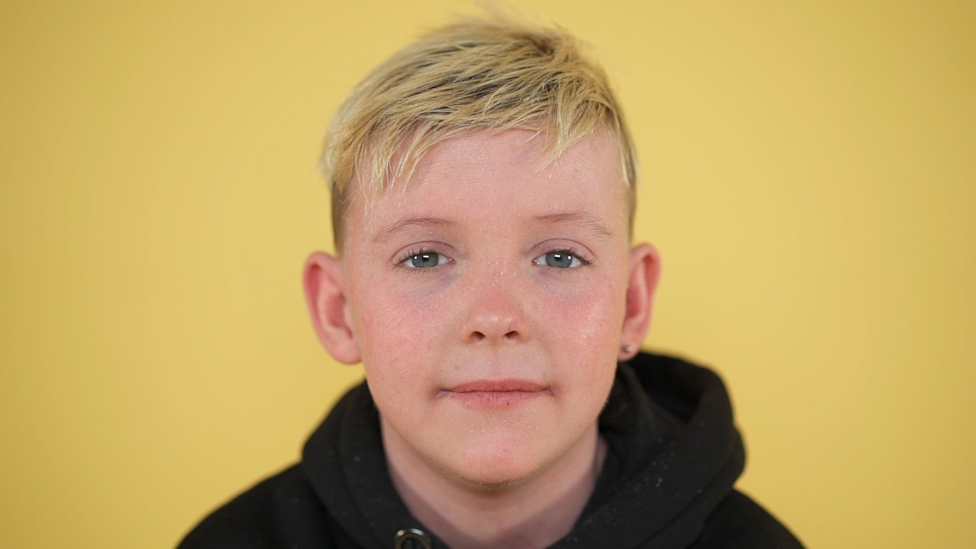A close up image of David, a 13-year-old white boy who short blond hair and a condition which causes his skin to blister and tear. He's wearing a black hoodie and looking directly at the camera.