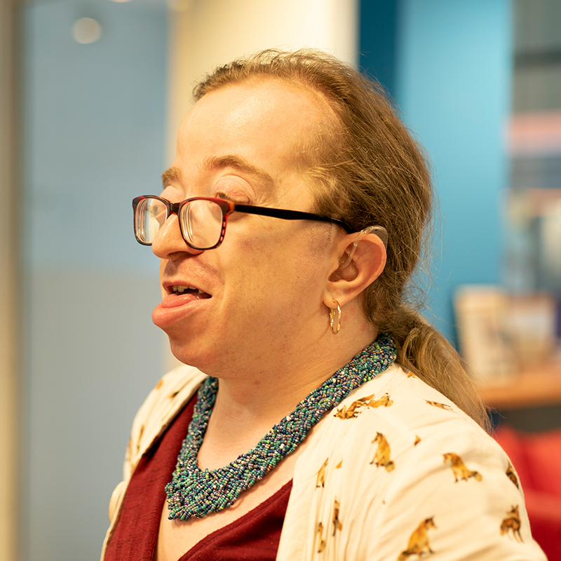 A woman with Crouzon syndrome wearing glasses and a green necklace looks to the left of the camera.