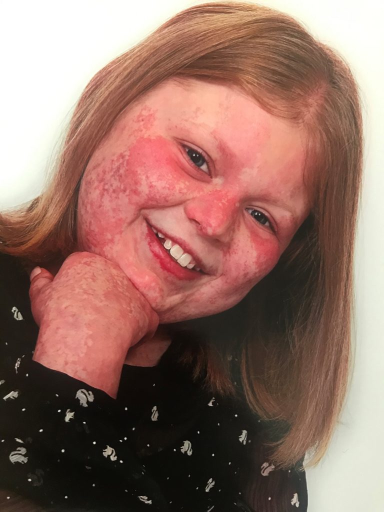 Amba at age 11, with her chin on her hand, looking into the camera, smiling.