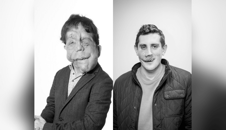 A composite image of two men with a visible difference