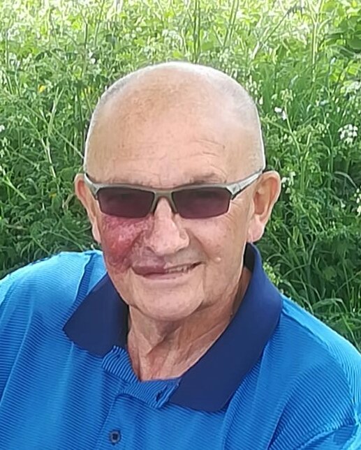 An older man with a port wine stain on his right cheek, outdoors with sunglasses