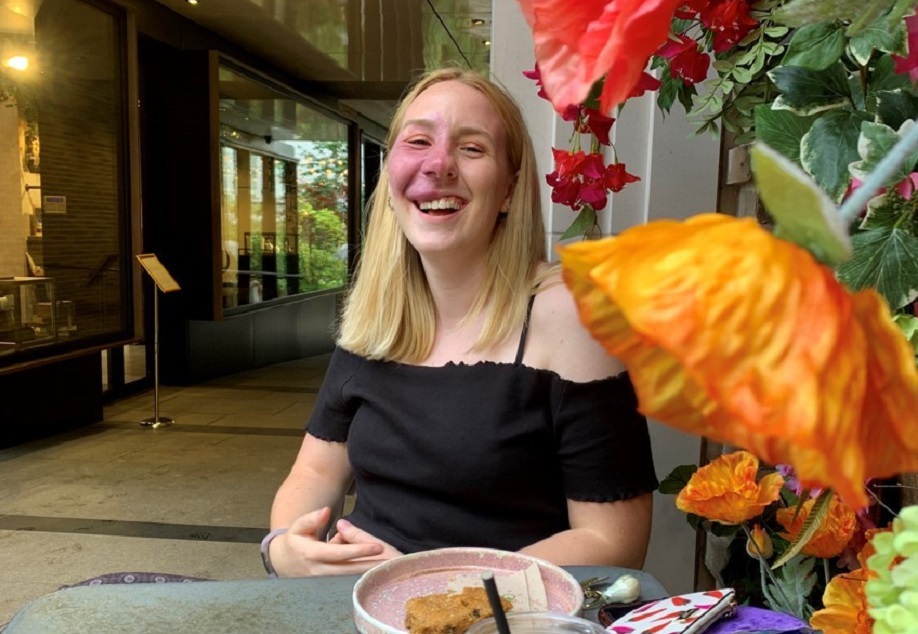 A young woman with a port wine birthmark and blonde hair smiles across a table next to bright orange and red flowers.