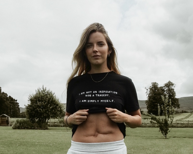 A young woman shows scars on her stomach. Her top reads: "I am not an inspiration, nor a tragedy. I am simply myself."