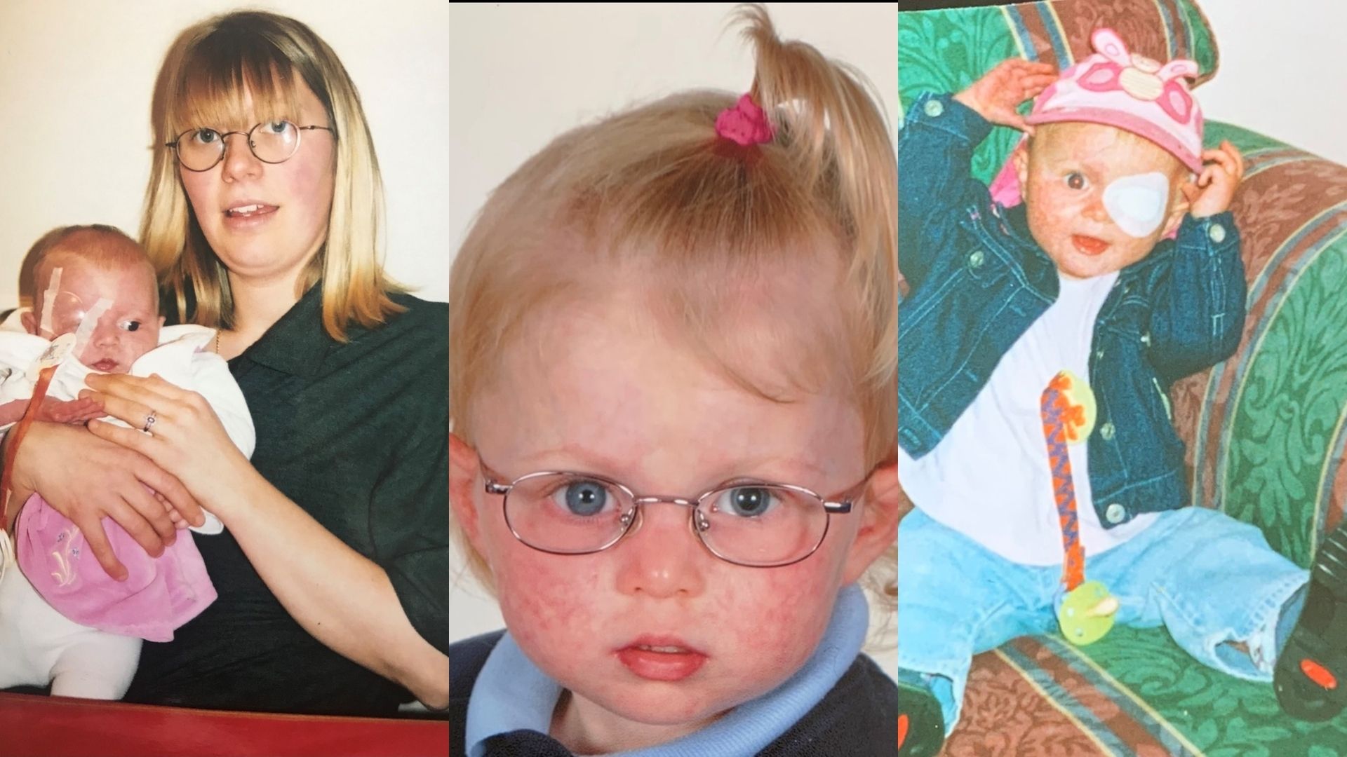 On left: a woman, mid-late 20s, with shoulder length blond hair and glasses is holding a baby in a white romper who has a patch over her right eye. In the centre: a school portrait of a young girl, 5-6 years old, wearing a blue polo, navy jumper and glasses. On the right: a toddler, sitting on a green and brown patterned sofa. She has an eye patch and short blond hair and is wearing a white t-shirt, light blue jeans and a navy jacket.