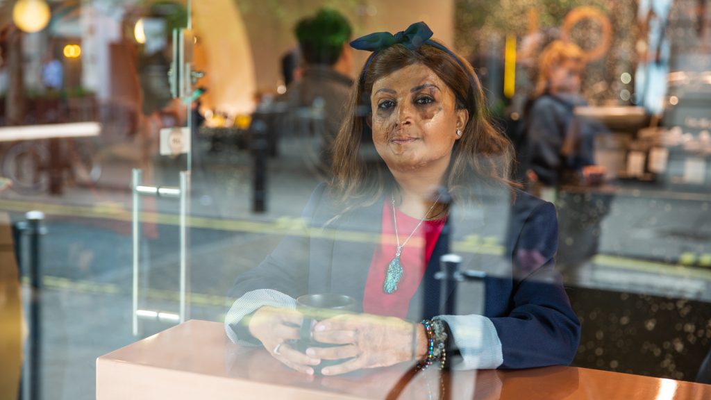 A woman with facial scarring sits in a coffee shop window, holding a glass