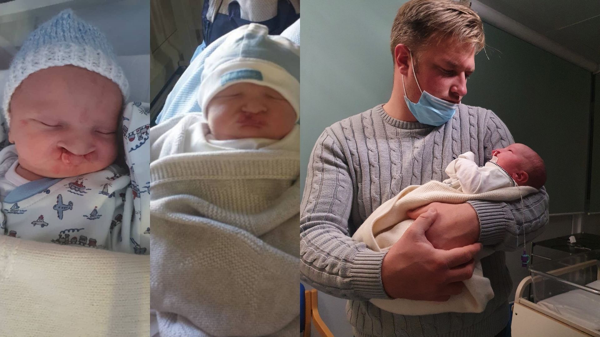 Left: Two babies, side by side, with a cleft lip and palate. Both are sleeping and wearing beanies, onesies with a blanket over them. Right: A man, late 30s, wearing a grey knit and a face mask holds his newborn baby Jude, who's wearing a onesie and is wrapped in a yellow blanket.