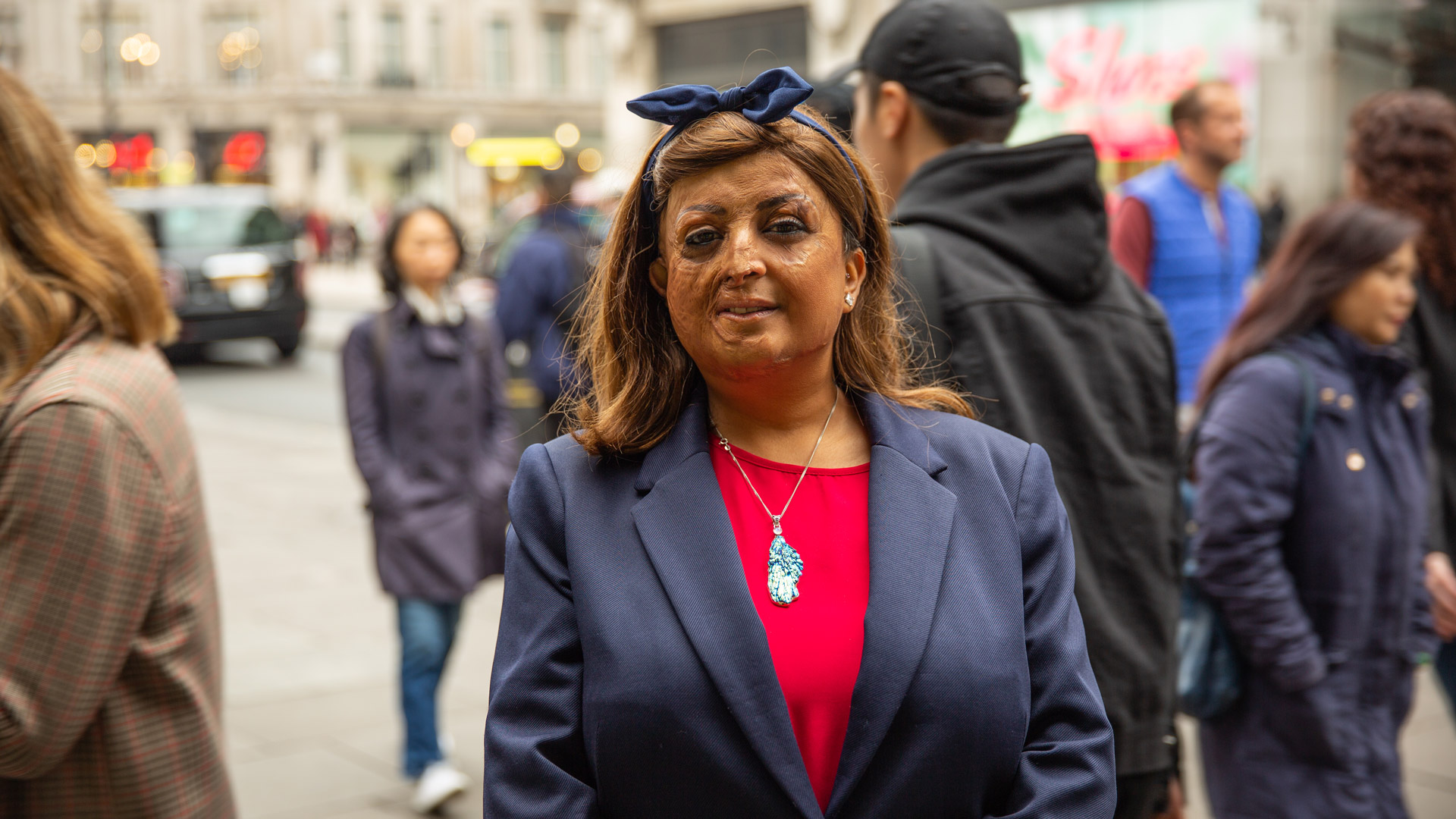 A woman with visible difference on a busy street