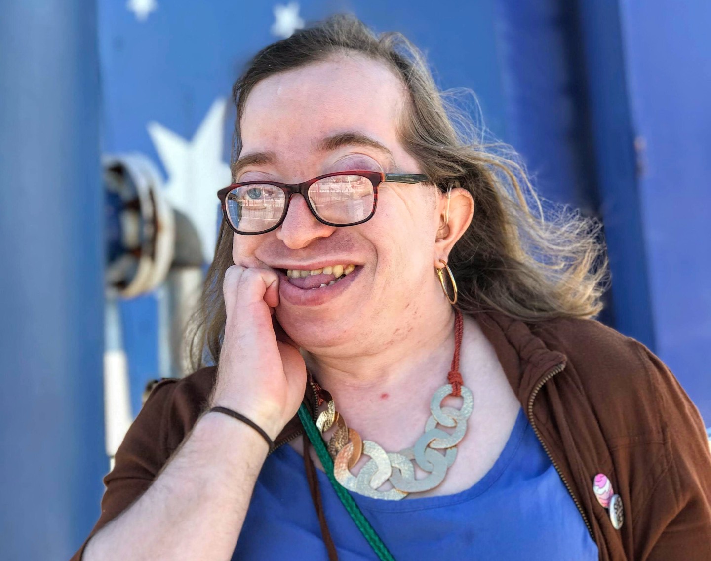 A woman with Crouzon syndrome wearing glasses and smiling at the camera