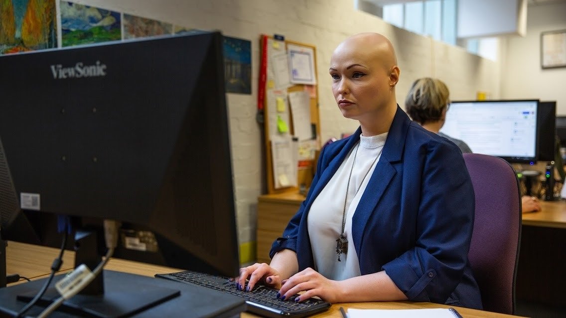 A woman with alopecia, wearing a blue jacket with a white top, works at a desk in front of a computer.