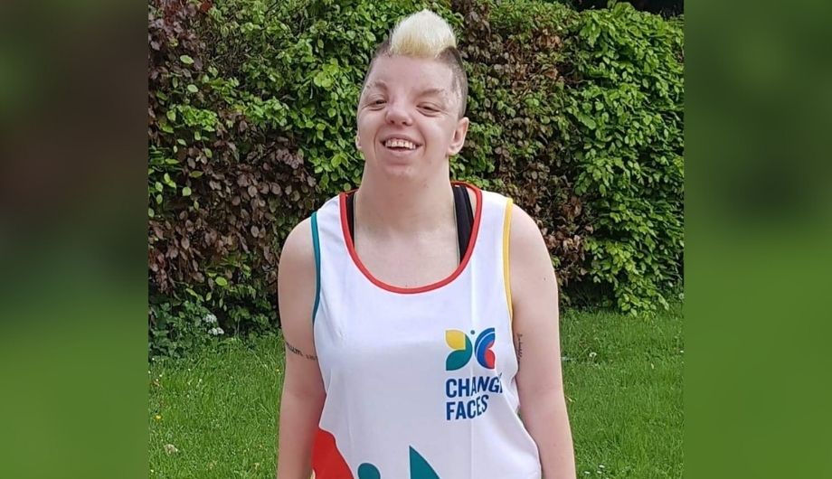Ella, one of our campaigners, wearing a Changing Faces running singlet and smiling at the camera.