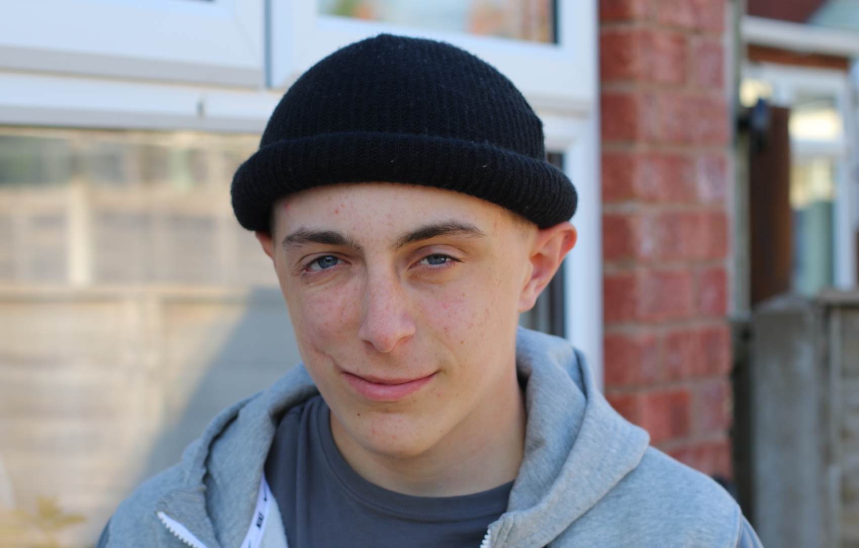 Marcus, who has facial scars on the right side of his face, wearing a black hat and grey hoodie, looks towards the camera with a slight smile