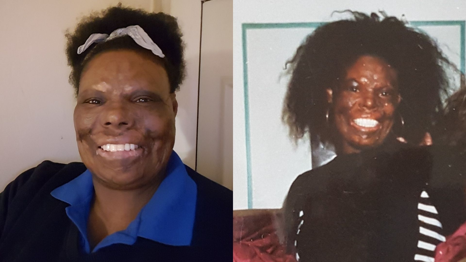 Left: Christine, a woman in her 40s/50s, wearing a black jumper and blue shirt. She's smiling at the camera and her hair is pulled up in a scrunchie. Right: Christine in her 30s, she is wearing a black top with a black and white lined dress over it. She's smiling at the camera.