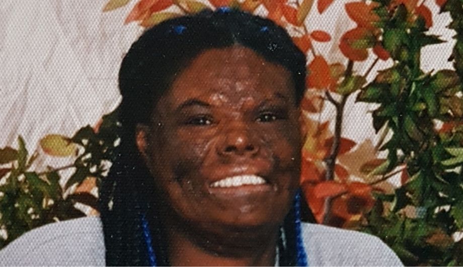 Christine, a woman with burns, 40s, she has black hair and is standing in front of some branches and leaves.