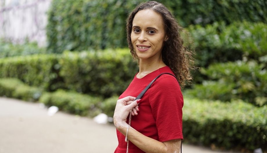 Natalie, a woman with vitiligo. She's wearing a red blouse, and has shoulder length curly brown hair. She's holding a purse on her shoulder and smiling at camera. Behind is a garden and tall hedge.