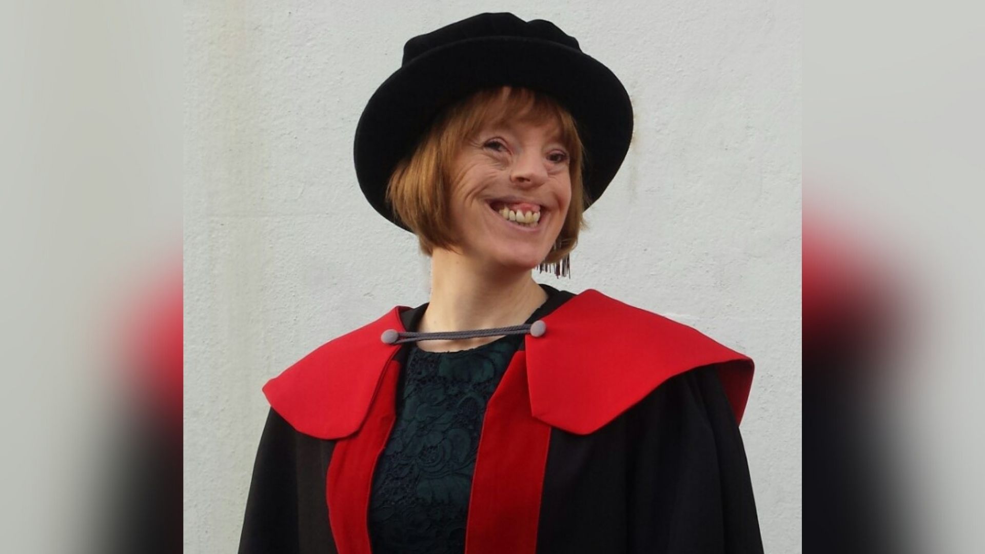 Amanda, a woman in her 40s, who has a cleft lip and palate. She has light brown hair and is wearing a black floral blouse, a black robe with a red lining, and a black hat. She is smiling at the camera.