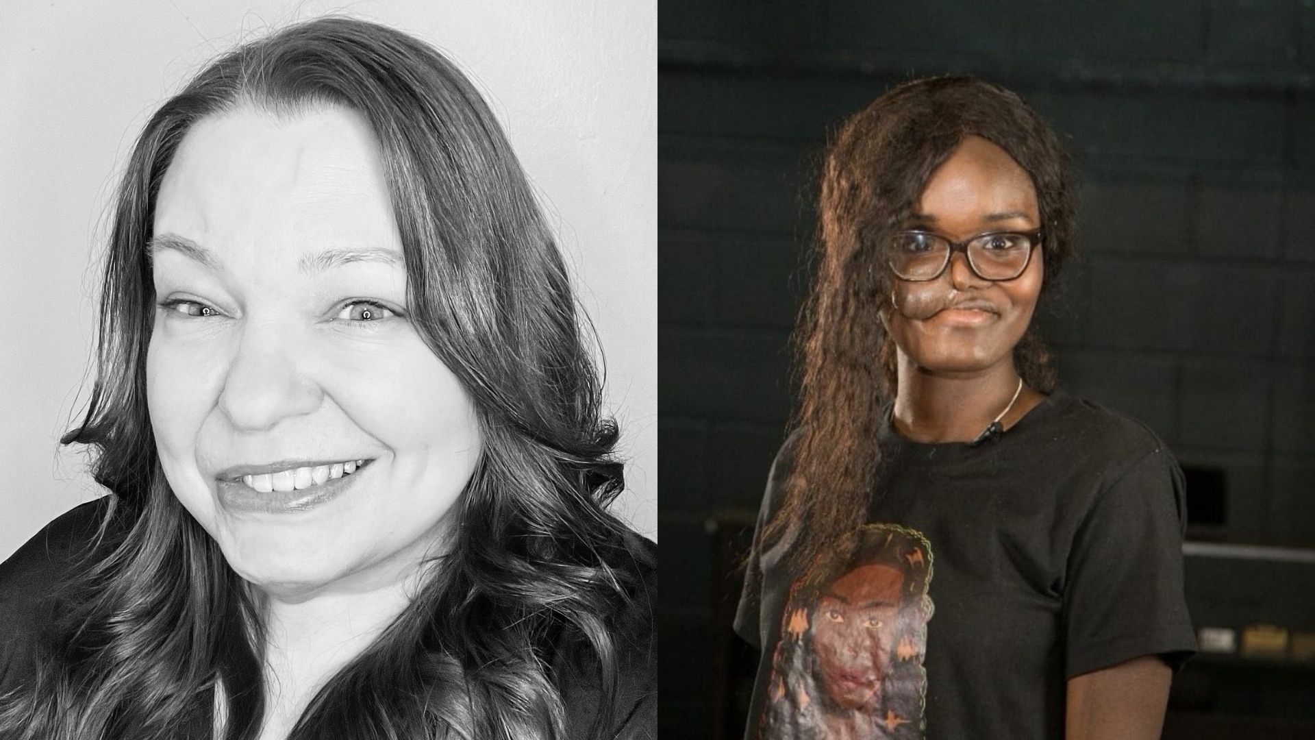 Left: a black and white image of Miranda Walker, a woman, 40s, who has some facial paralysis. Right: Crystal, a woman in her 20s, with a skin flap on her cheek. She's got long hair and glasses and is wearing a black t-shirt.