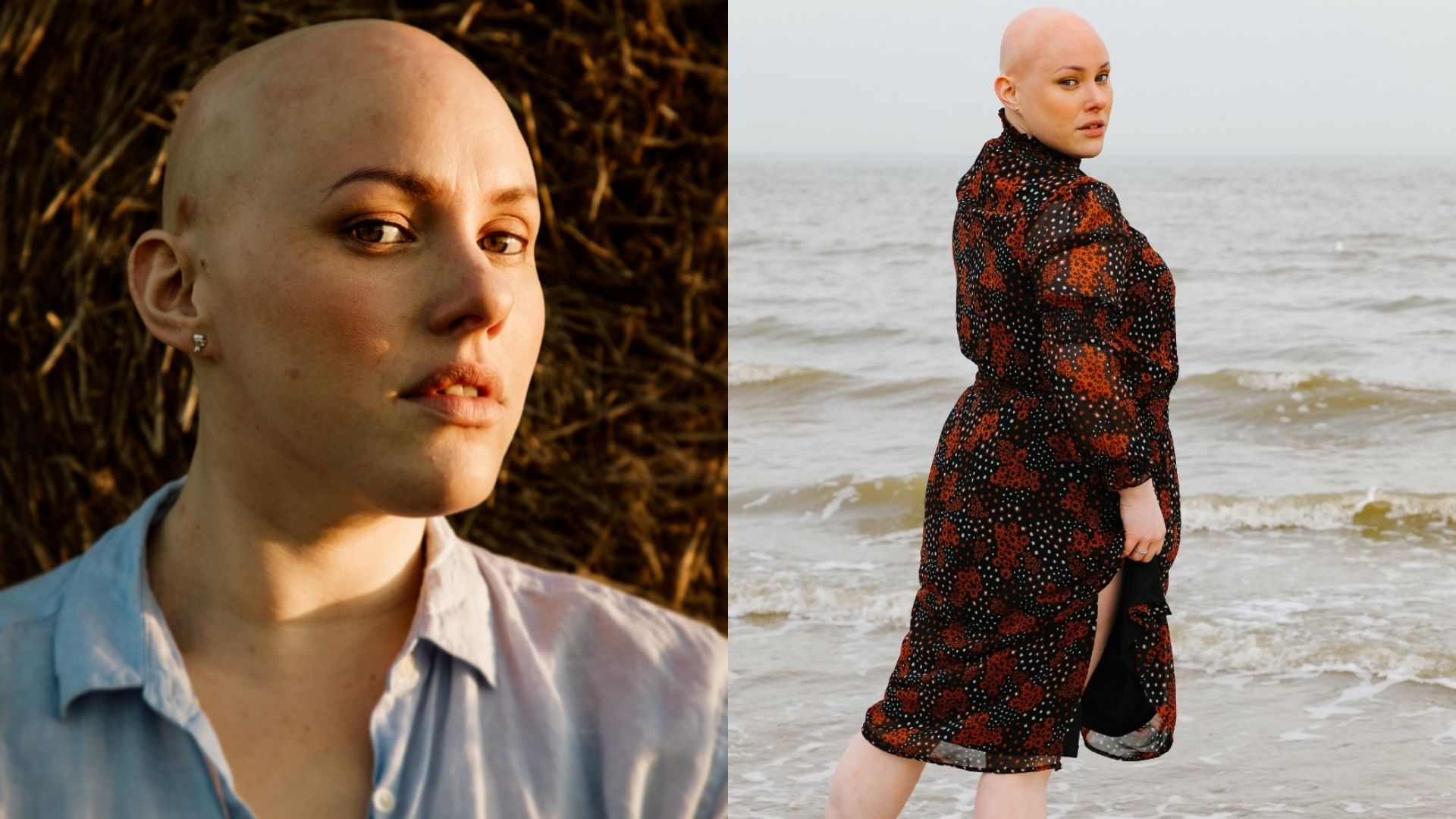 Left: a close up of Laura, a woman in her 20s/30s with alopecia and green eyes. She's wearing a light blue blouse and standing in front of a hay bale. Right: a medium shot of Laura standing at the edge of the sea and looking back towards the camera over her shoulder. She's wearing a black and red floral print dress.