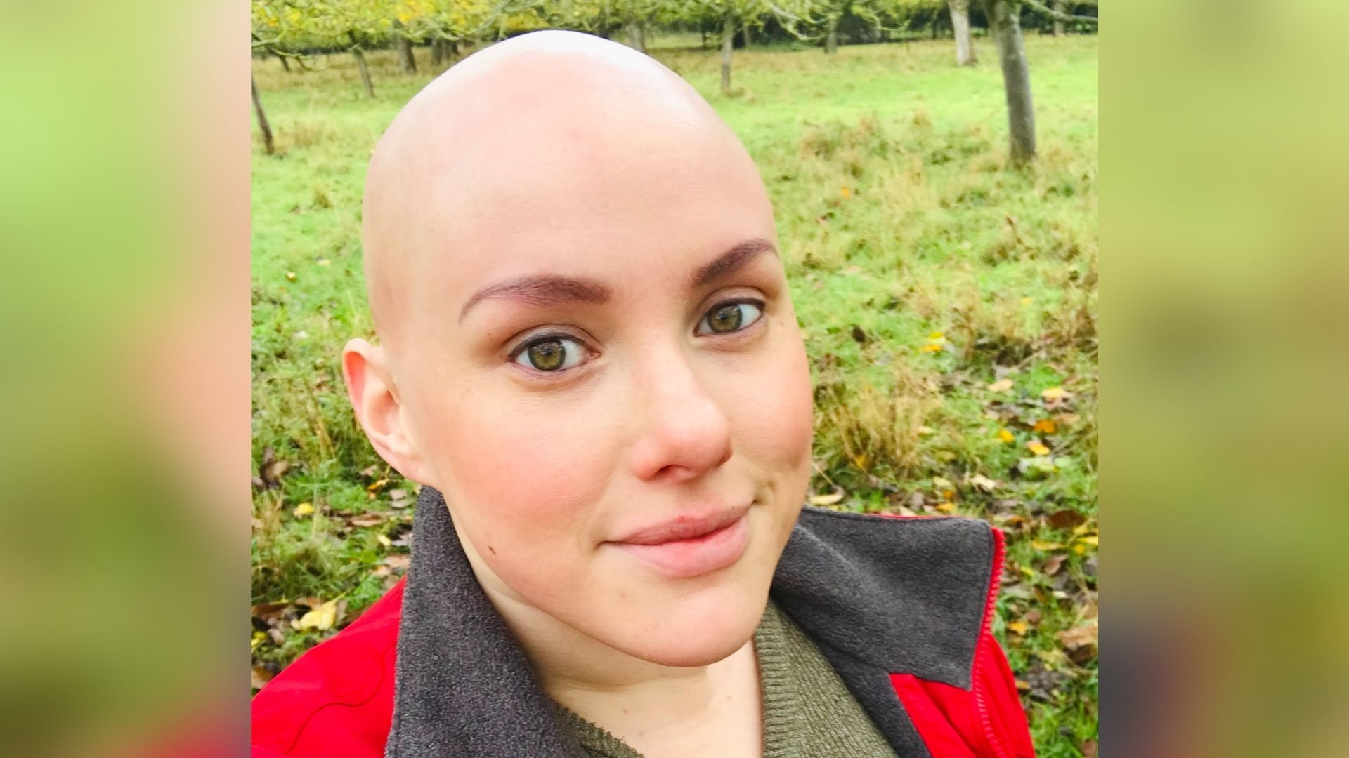 Laura, a woman with alopecia. She has green eyes and is wearing a red fleece with a grey lining and looking at the camera. There's a field behind her.