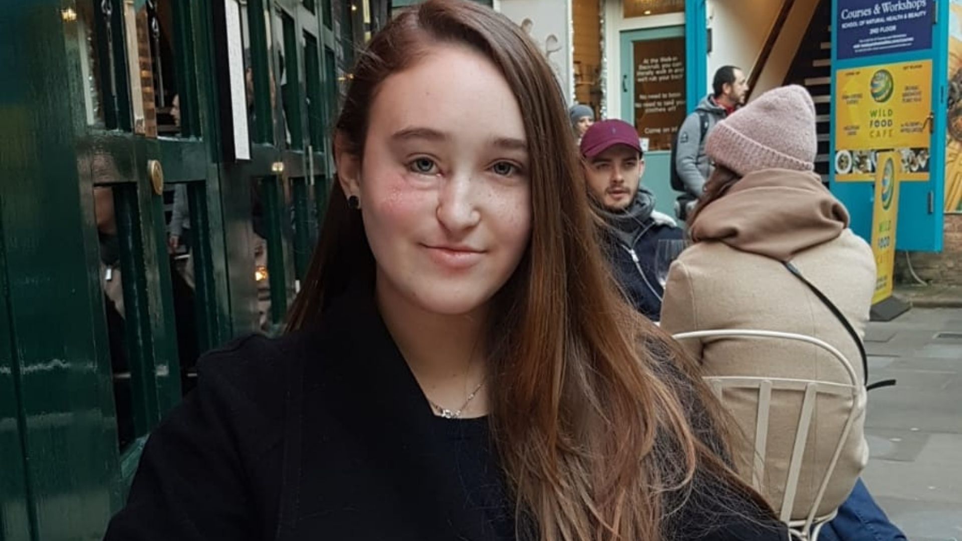 A young woman with scarring around her right eye and long brown hair, sits outdoors at a cafe table, with other people in the background