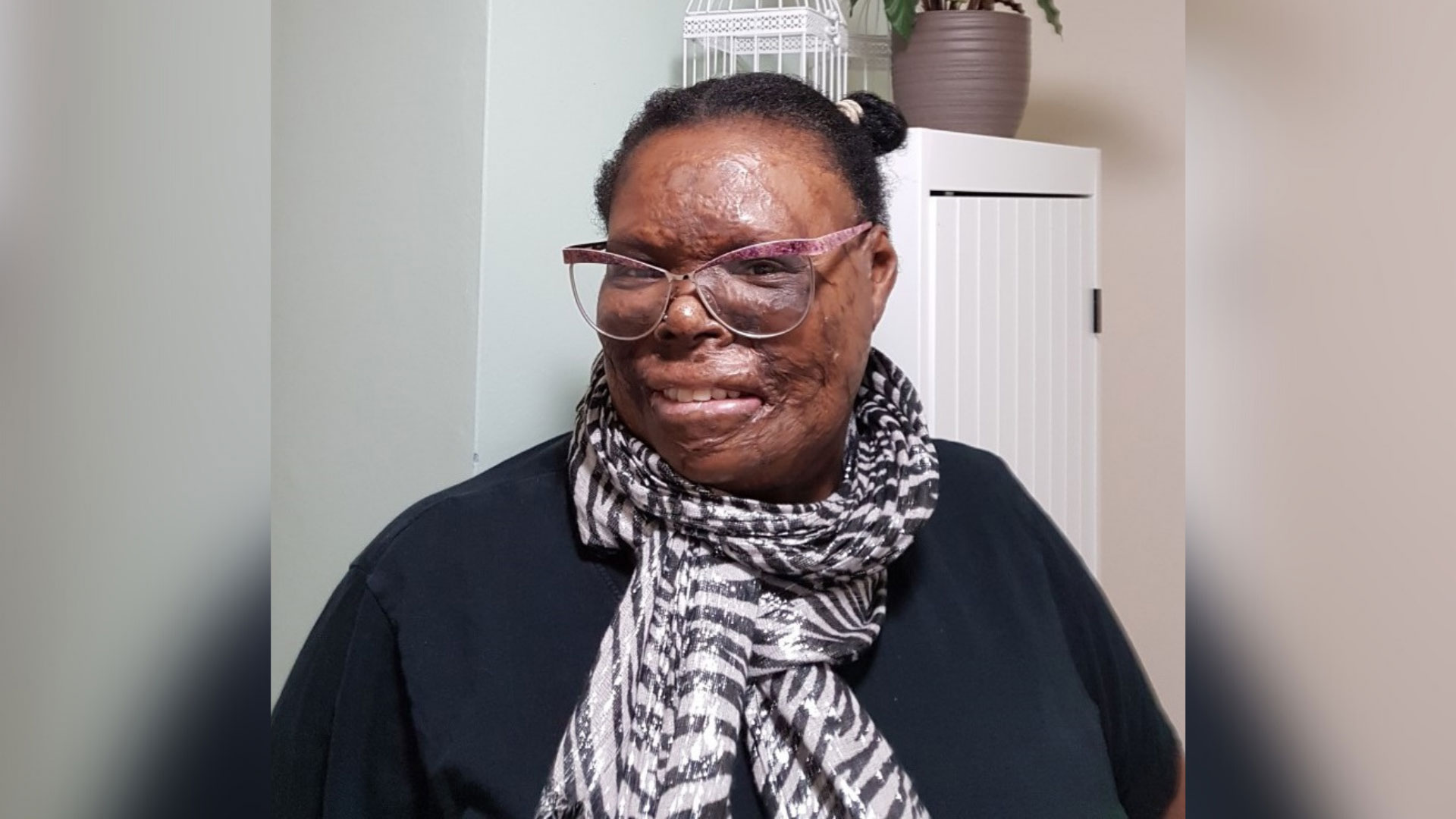 Campaigner Chrissie who is a Black women with a visible difference wearing a white and black scarf and black top, pink glasses and her hair in two buns on top of her head.