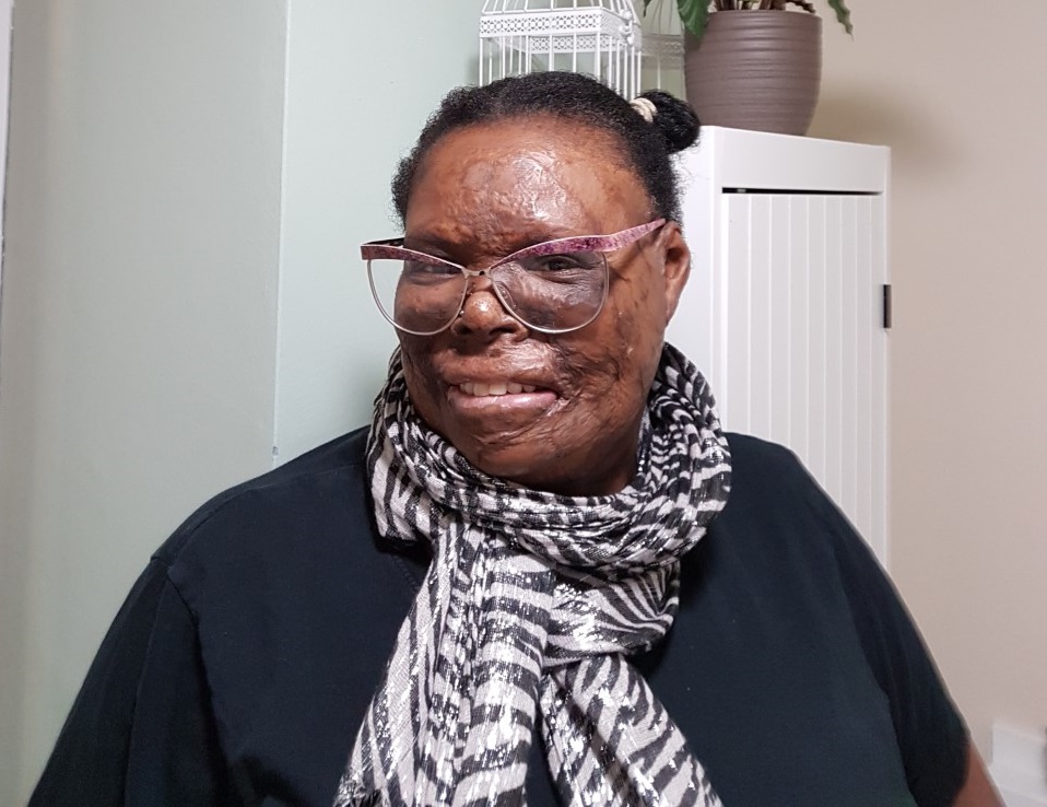 Campaigner Chrissie who is a Black woman with a visible difference, wears a white and black neck scarf and pink glasses, with her hair in small buns on top of her head.