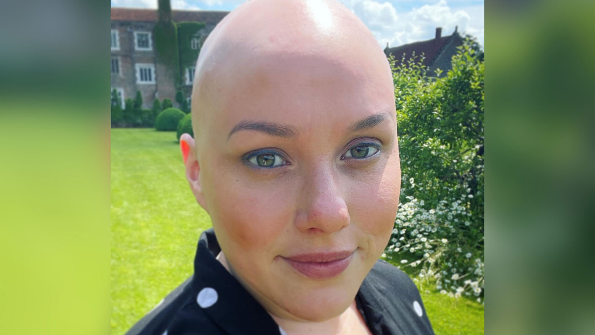 Campaigner Laura is a white woman with alopecia and is bald. She is wearing a black top with large white polka dots and has grass and trees behind her.