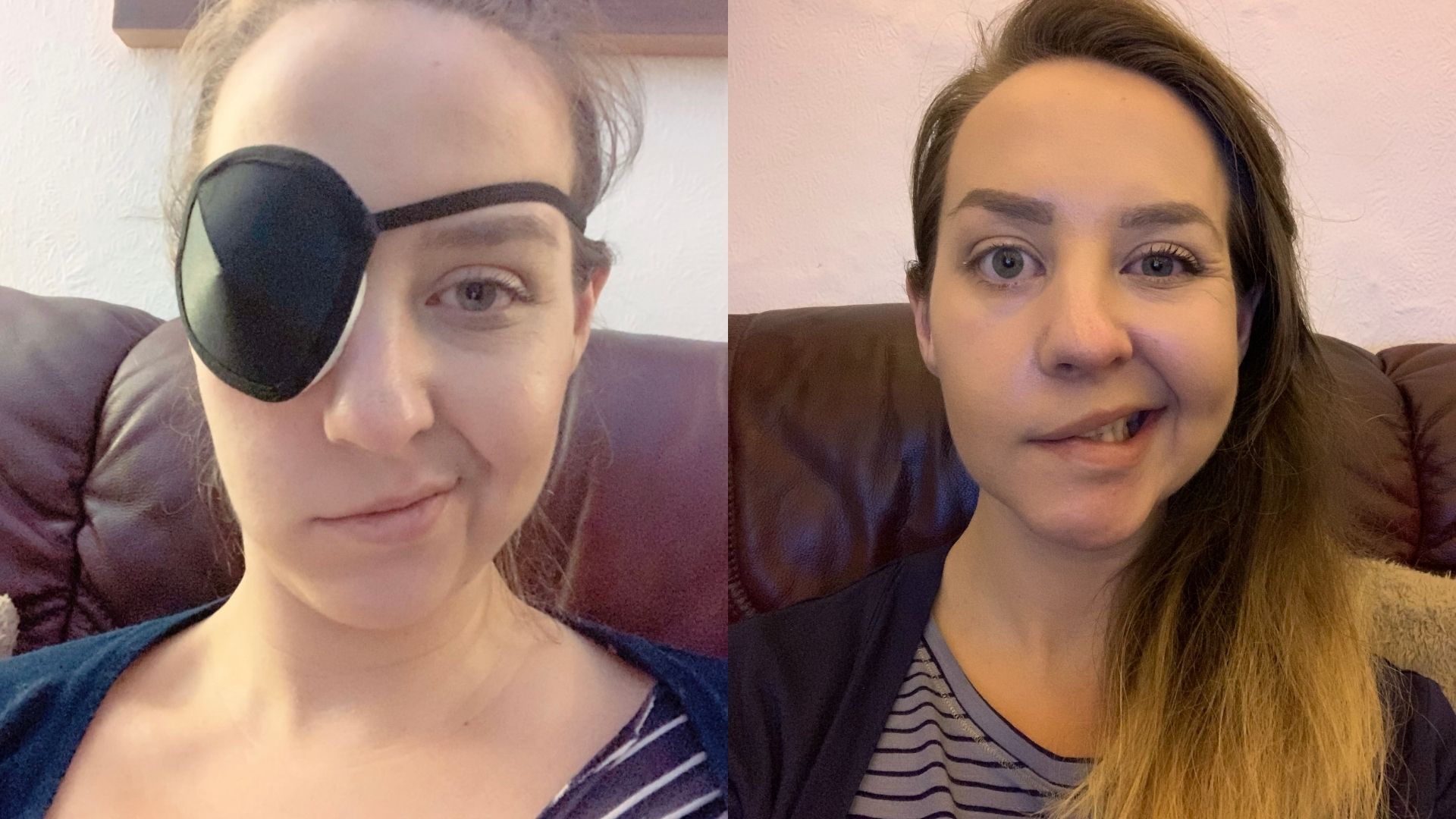 Left: Nicoya, a white woman in her 30s who has brown hair and right sided facial paralysis. She's wearing a black eye patch and looking at the camera. Right: Nicoya is wearing a striped grey t-shirt and black cardigan and looking at the camera.