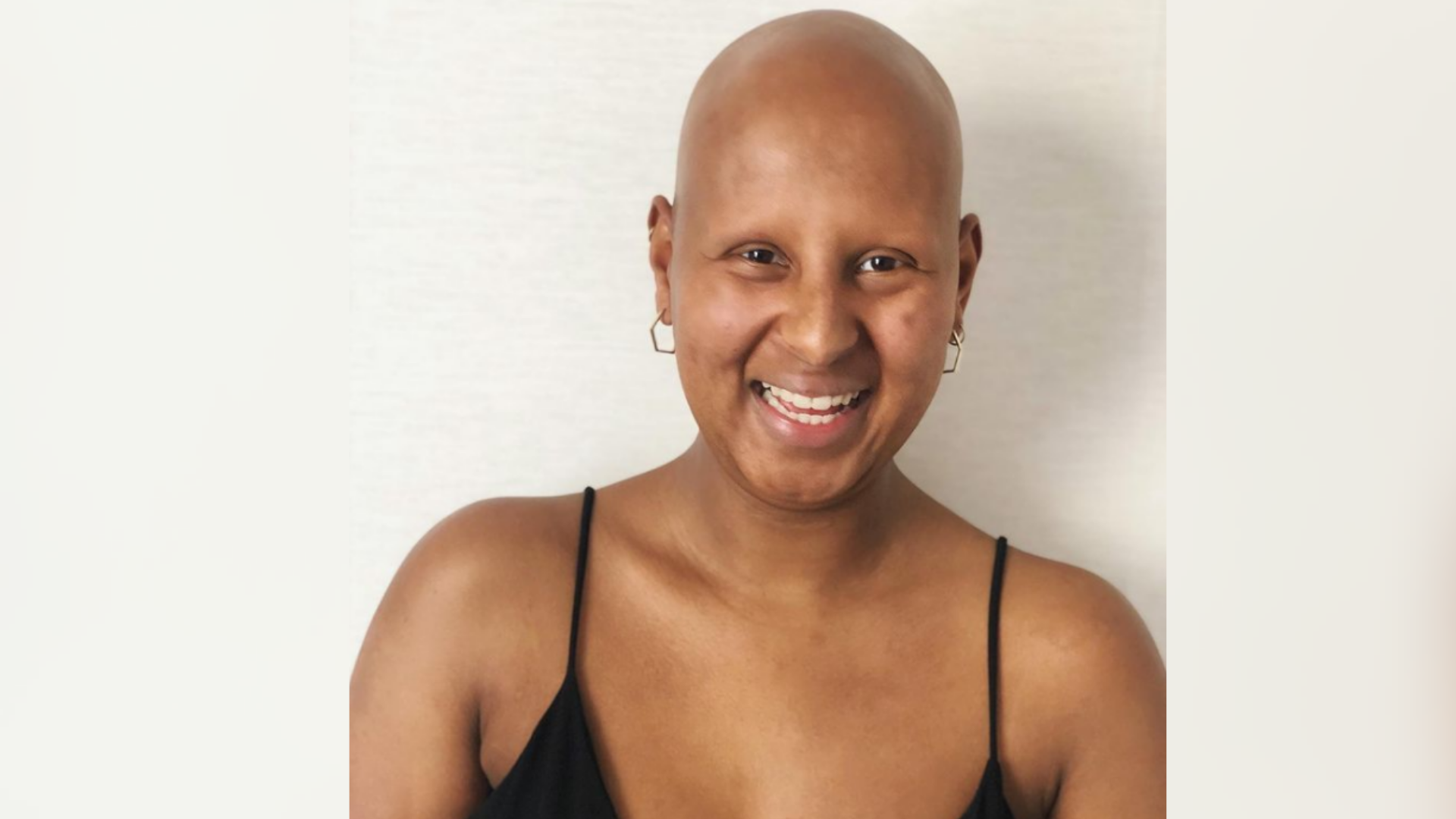 Jess is an actor with alopecia. She is wearing a black cami top and gold hoop earrings, and smiles at the camera. She is stood in front of a white background.