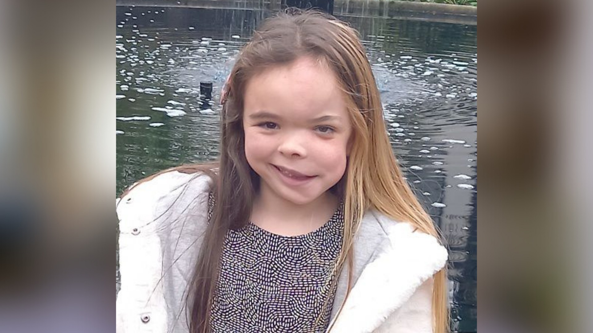 April, is seven years old and has blonde hair on the left side of her head, and brunette on the right. Her visible difference is seen through the bones in her left cheek and jaw bones, making the left side of her face appear larger. April smiles at the camera, she is stood in front of a pond and is wearing a fluffy white coat and black spotted dress.