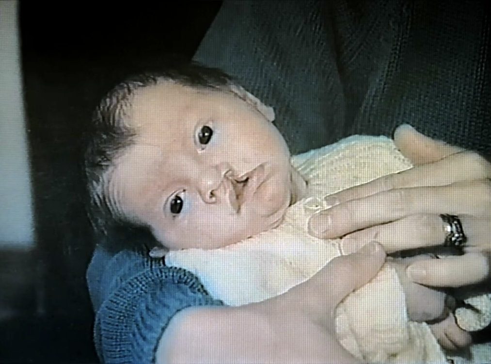 Ryan as a baby in his father's arms - who is out of shot. Ryan is staring at the camera and has a cleft.