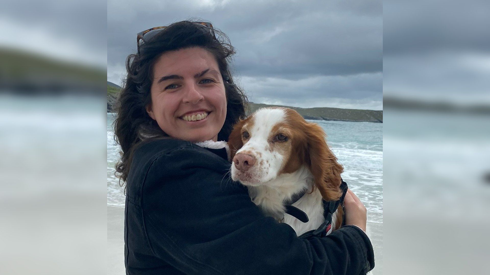 A woman with a visible difference holding a dog on a beach