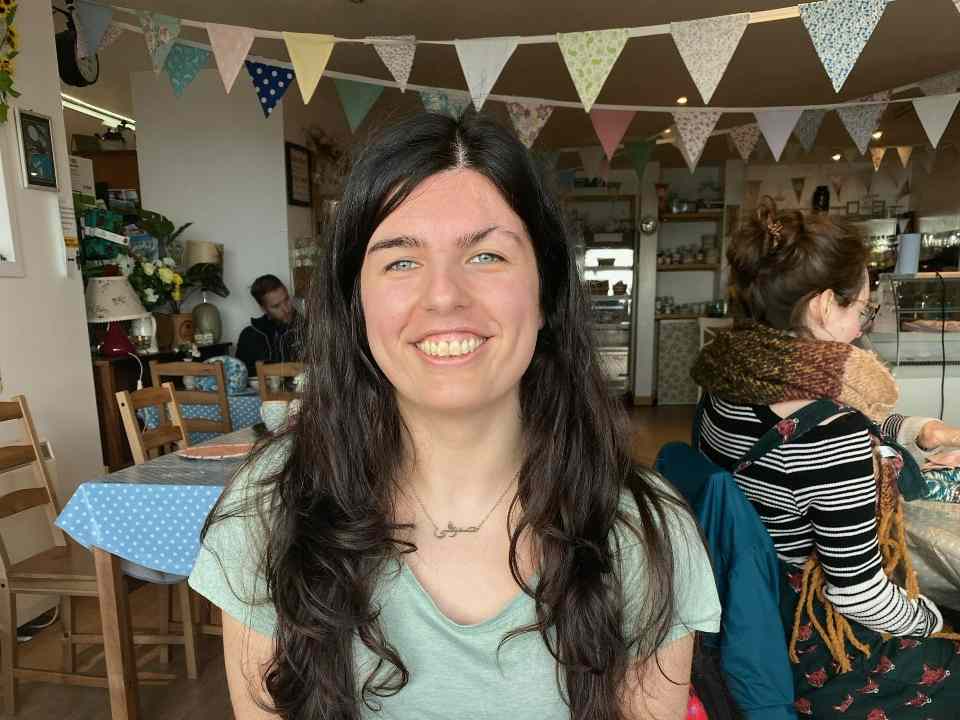 A young woman with a facial scar sitting in a cafe smiling at the camera