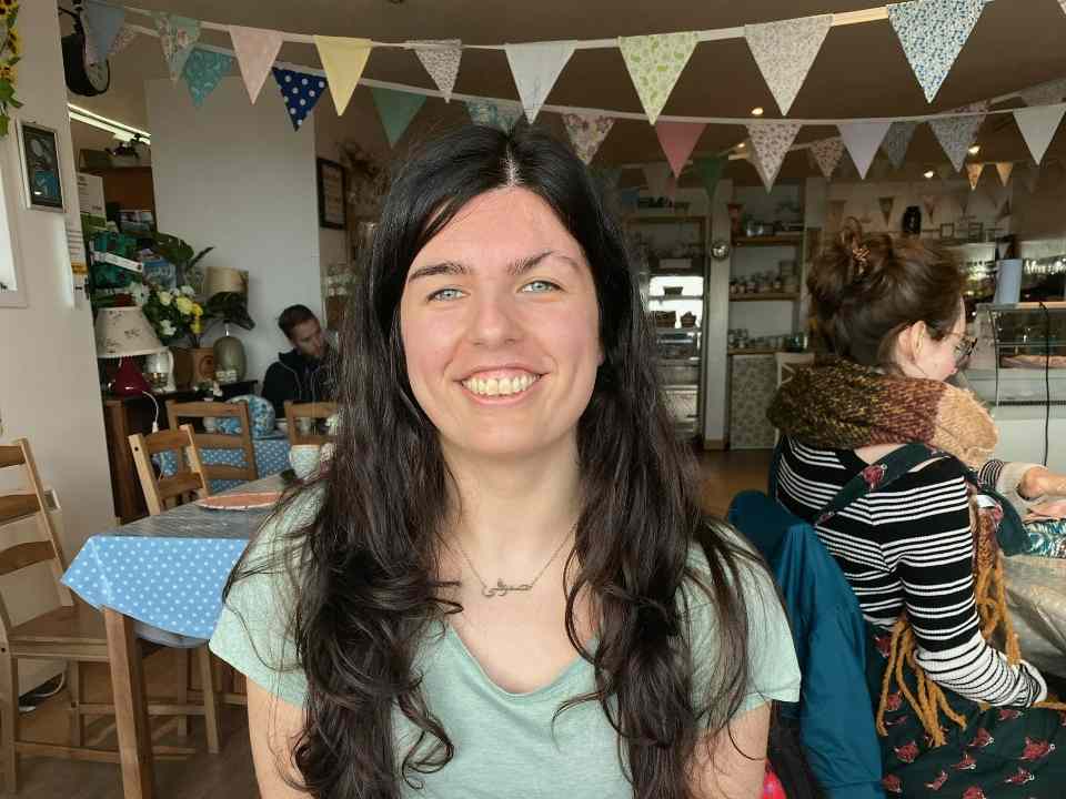 A young woman with a facial scar sitting in a cafe smiling at the camera