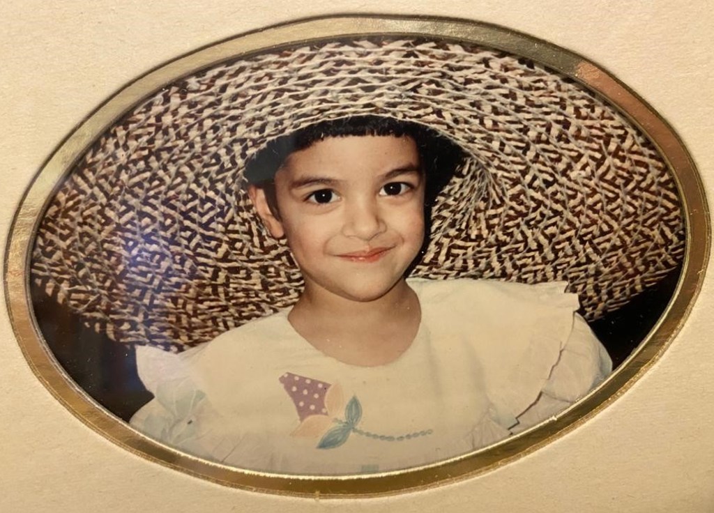 Child with a scar above their lip smiles in photo