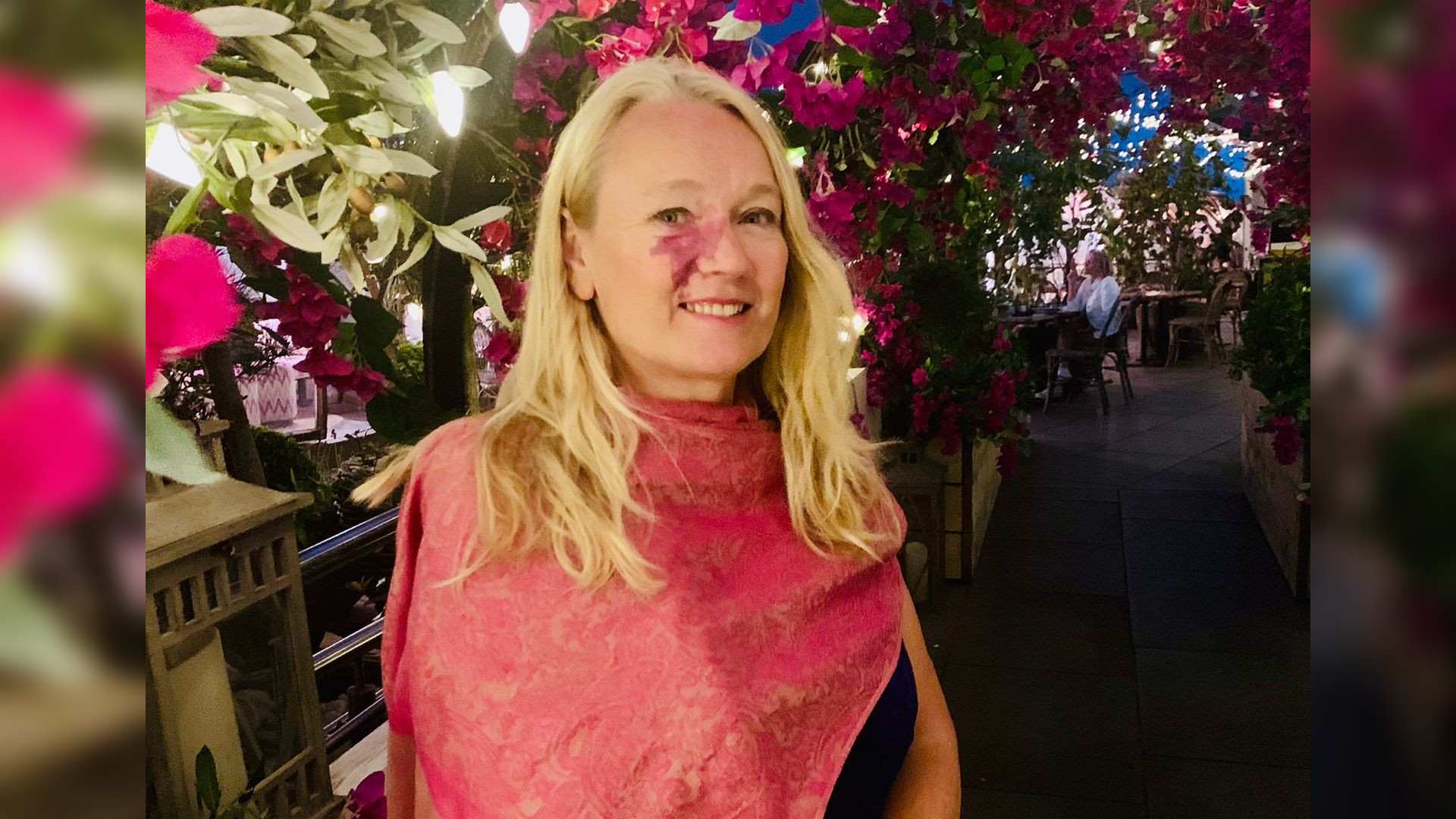 Blonde woman with port wine stain birthmark on her cheek stands among pink flowers