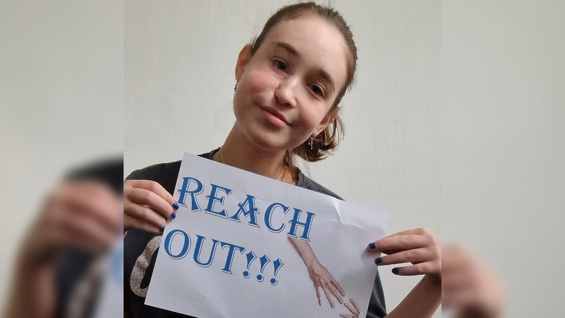 Girl with facial scarring holds up sign saying Reach Out