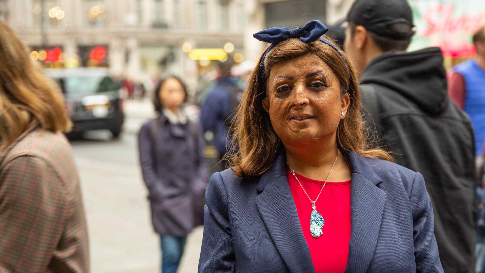 A woman with facial burns standing in a busy street