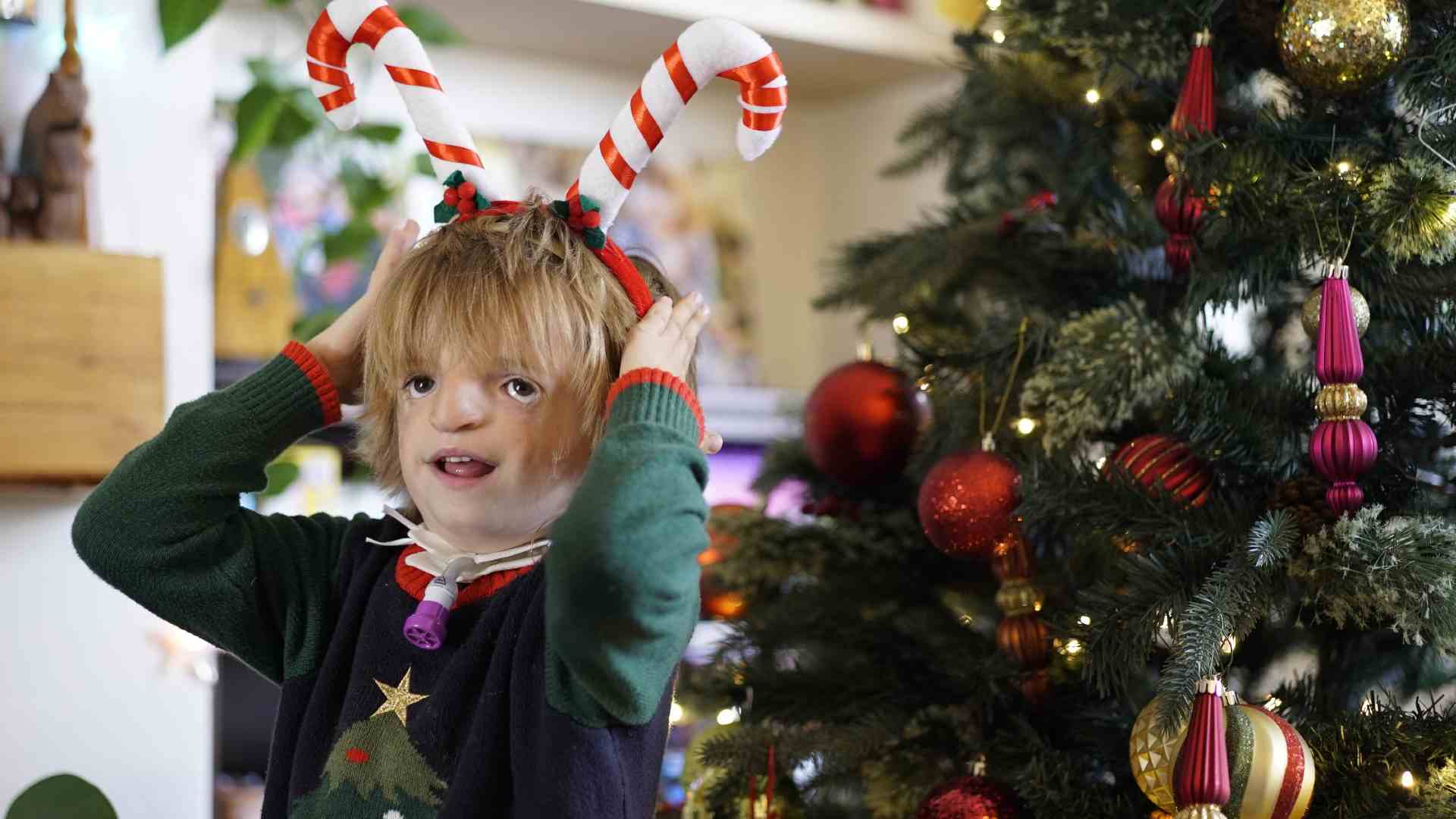 A young boy with a cranio-facial condition holds candy cane antlers on his head