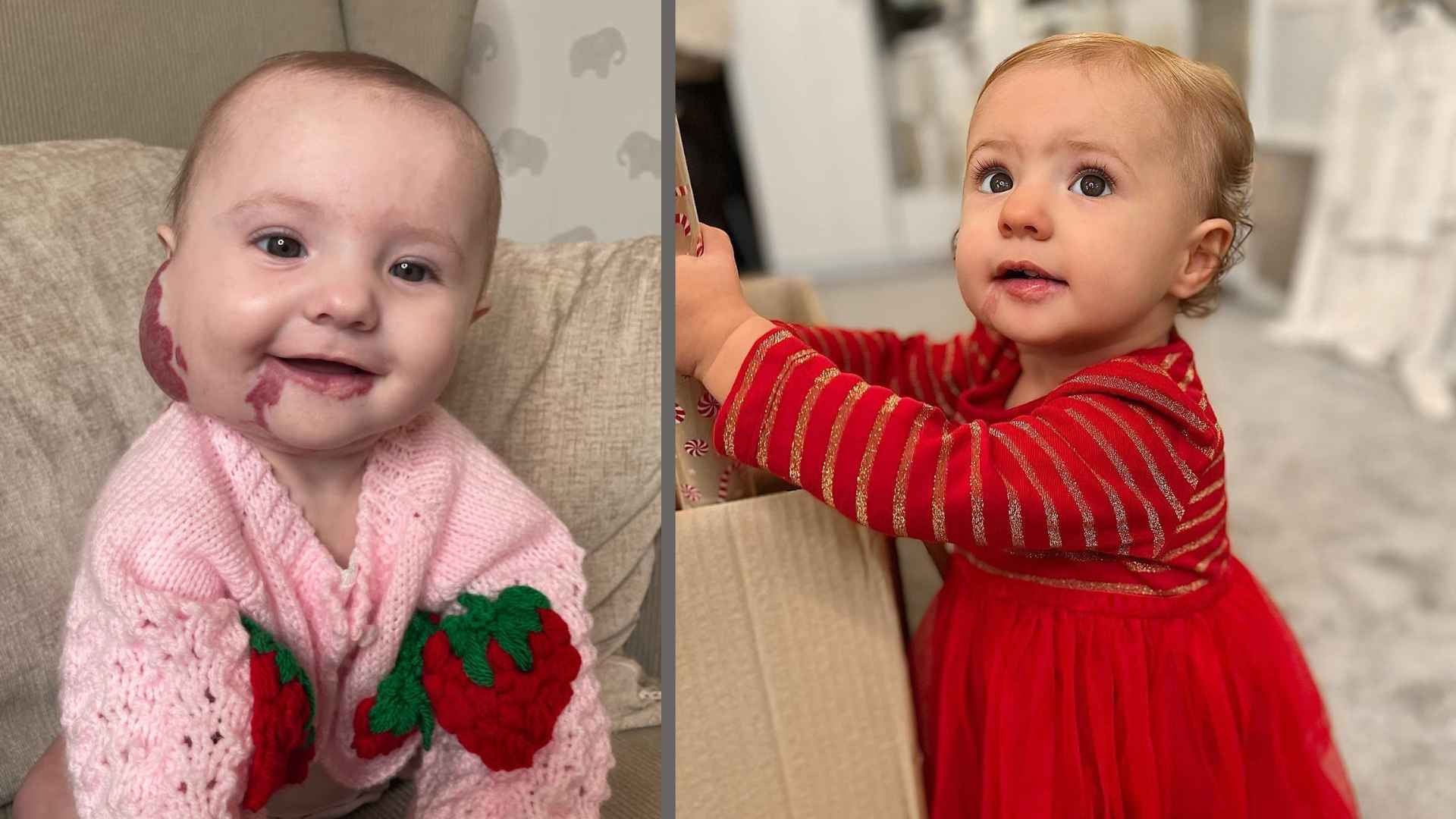 Two photos of lola: the first, she is younger and her strawberry more prominent. The second more recent, dressed all in Christmas red.