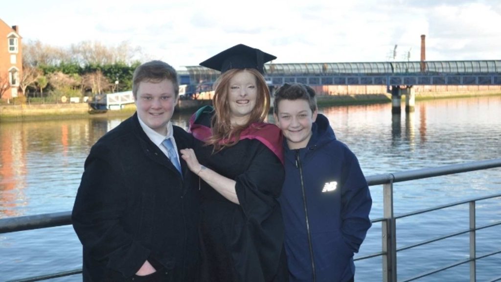 Woman with burns scars stands in a graduation outfit with her sons near a river