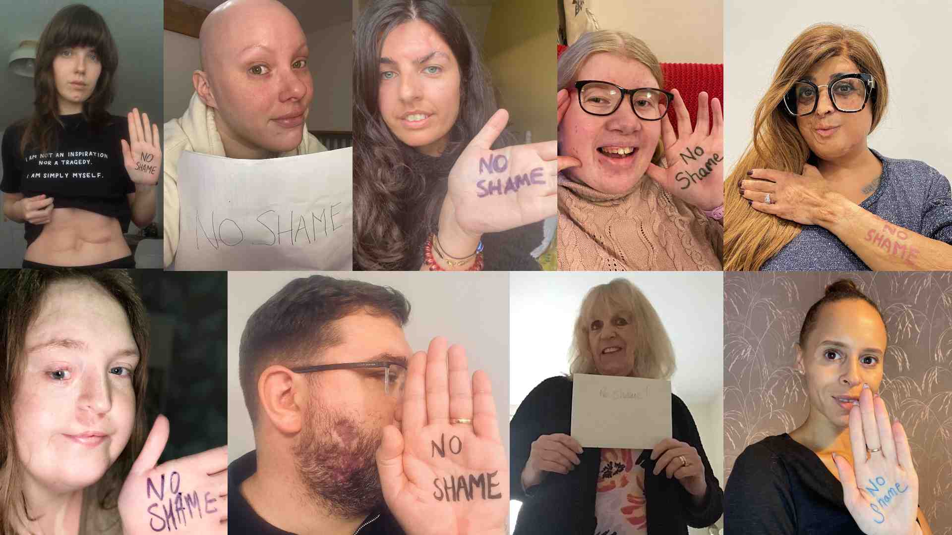 Collage of campaigner pictures each with no shame written next to scars and visible differences