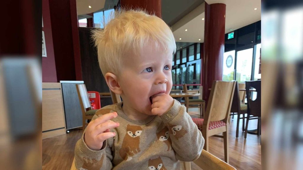 A toddler with albinism sits in a cafe eating