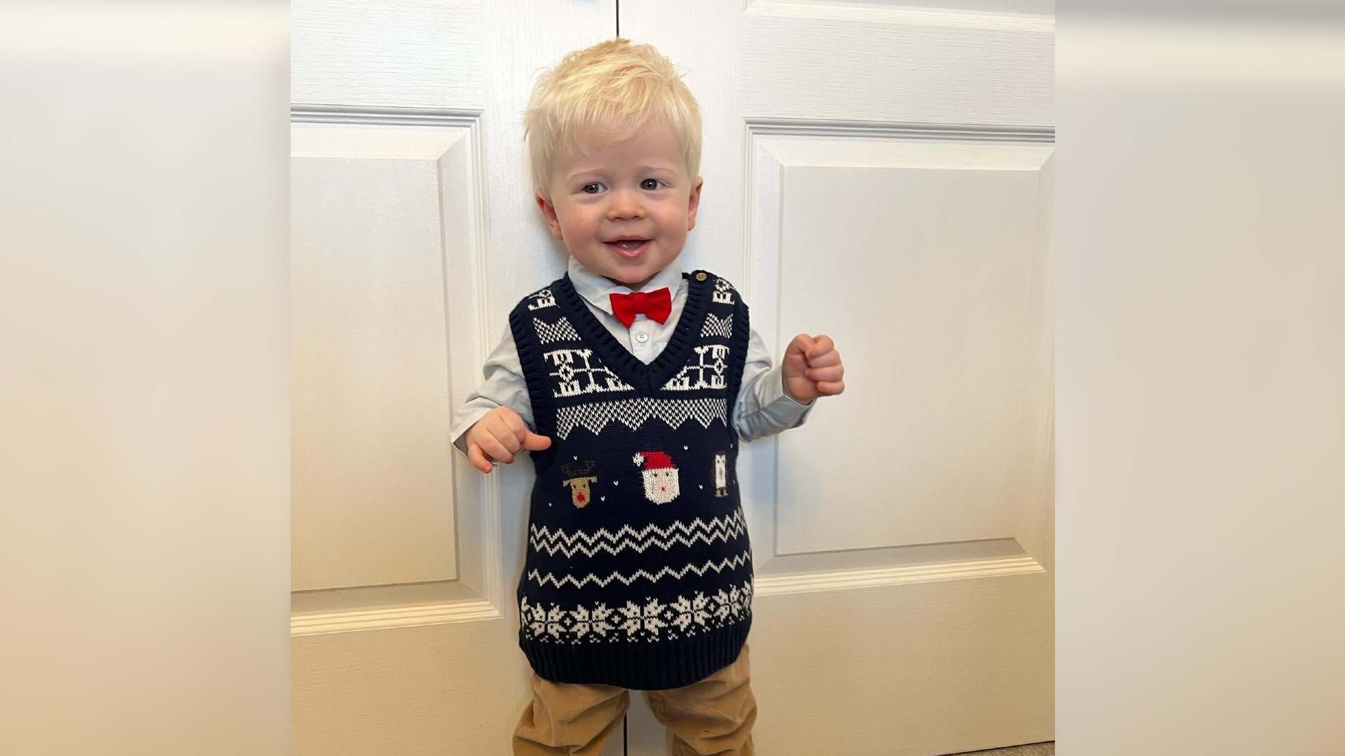 A toddler with albinism wears a Christmas jumper and bowtie