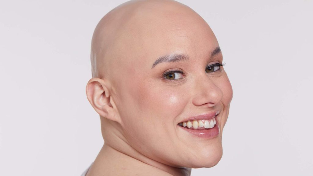 A white woman with a bald head, turning to smile towards the camera