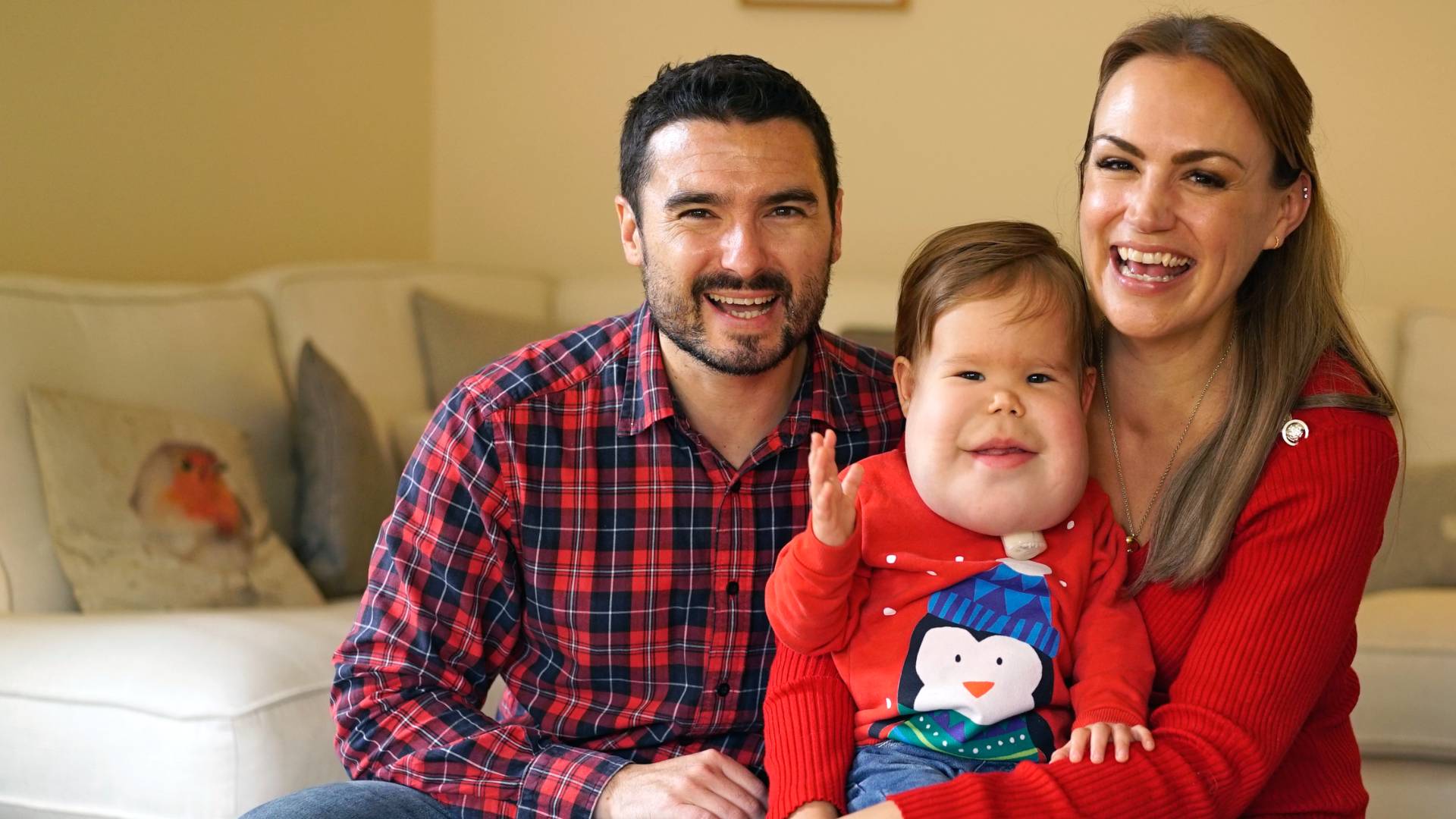 Finley, a two year old boy with lymphangioma, which causes swelling in the lower half of his face, with his mother and family.