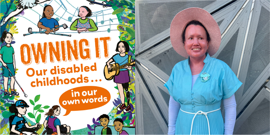 The front of the book Owning It by Faber Books and Carly wearing a blue dress and hat. Carly has ichthyosis.